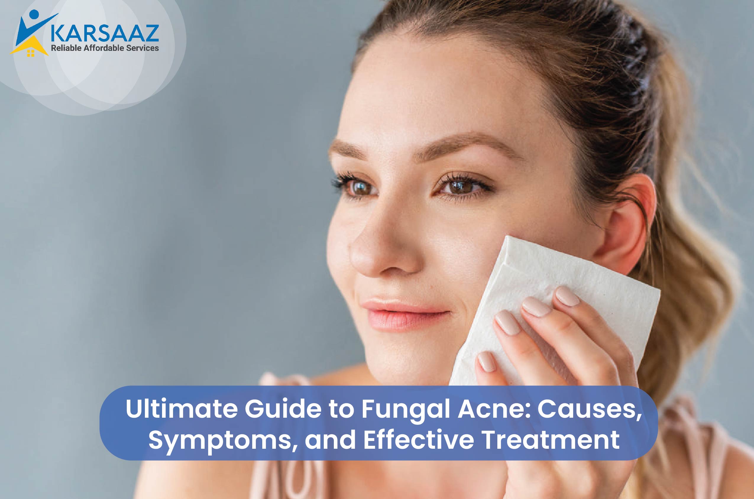 ultimate-guide-to-fungal-acne